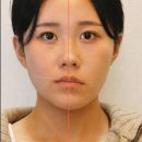 중앙드림치과의원 | 양악을 피할 얼굴비대칭 교정의 비밀 대 공개! 비용 정보