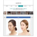 신데렐라성형외과의원 이미지