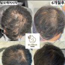 도노포레스타 두피케어(산본점)