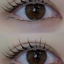 주식회사 광명제일주유소 | 피부 때문에 맘고생 좀 했던 썰 풉니다