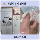 레푸스연신내점 | 연신내역 문제성발톱 내성발톱 깔끔하게 정리하는 레푸스 연신내점, 문제성 발톱 케어 후기