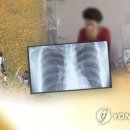 &#34;폐렴 사망자 10명 중 9명이 노인…고열·기침·가래 잘 살펴야&#34; 이미지