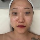 세븐일레븐 청주뉴모충타운점 | 청주웨딩관리 &#39;정담에스테틱&#39; / 청주 윤곽관리 강서동 피부관리