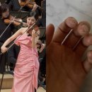 피나는 노력으로 한 | 🎻 서현 바이올린 협연 후 공개한 손가락, 피나는 노력의 증거