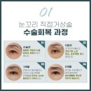 오직탄력의원 이미지