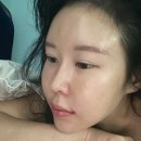 온다 리프팅