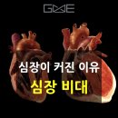 심비대, 단순한 심장이 커진것이 아닙니다.