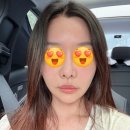 청담뷰티김선생 | 청담 피부과 힐로웨이브 망한 후기 👍내돈내산