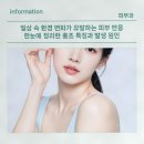 일상 속 환경 변화가 유발하는 피부 반응 한눈에 정리한 홍조 특징과 발생 원인
