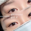 비올라(violla) | 부산 점막 아이라인 [점막들림 2탄] 들린 눈, 안 들린 눈은 디자인 위치가 다릅니다.