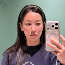 백만약국 | 피부과에서 5g리프팅 ( 실리프팅 + 리프팅주사 + 유스필 ) 받은후기 통증 붓기 전후 가격 포함입니다.