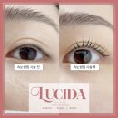 혁신뷰티의원 이미지