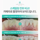 컴플란트치과의원 이미지