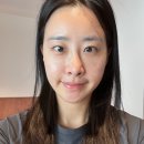 387 | 청담피부과에서 헬리오스387 레이저토닝 받고 온 후기! / 통증, 주기, 비용