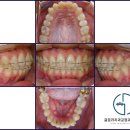 글로리치과교정과치과의원 이미지