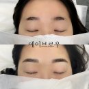 에이브로우 이미지