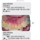 순천365치과의원 네이버블로그
