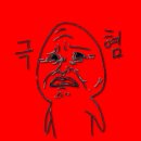 망포약국 | 심한치질 자연치유 절대 안돼요 치핵수술 후기 치핵 4기 망포 항문외과