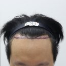 압구정맘모스헤어라인의원 이미지