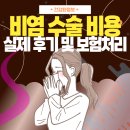 비염 수술 비용 및 후기(보험 처리)