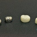 효치과기공소 이미지