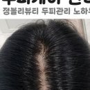 정블리뷰티 - 남구 | 정블리뷰티