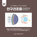 새론의원 | 후 인공눈물을 뗄 수 없는 분들은 필독! 안구건조증 관리 방법 추천 [출처:대구중구안과 서울새론안과의원]