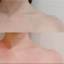 아비디따 이미지