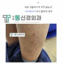 포항제통신경외과의원 | MD보습스프레이, 어린이 아토피 로션 병원 [서부통신경외과] 메티스덤 하이드로, 실비 되는 로션, 달서...