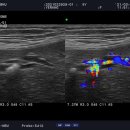 Twinkling artifact in small animal color-Doppler sonography 이미지