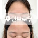 신내10단지 | 중랑구 눈썹 정리 헤어라인 이마 왁싱 전문 뷰티샵 인브로우