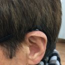 엠에스보청기 | [송파 보청기] 충전식 포낙 보청기 착용 후기-32일차