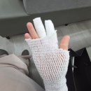 전동물병원 (출장진료전문병원) | 전자레인지 증기화상, 손가락 화상 치료 후기｜응급처치부터 화상 전문 병원 치료까지