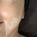 김해메디케어 | 장유피부관리 페이스 윤곽리프팅효과 대박후기 고운라인에스테틱
