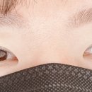 까진속눈썹