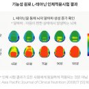 불안증 약 비교분석 이미지