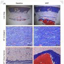 조이피부과의원 | 마포피부과 최근 나온 세르프 리프팅 효과 믿을 수 있을까