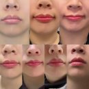 파주 야당 입술반영구 잘하는곳 : 예나로운 탈각 후기