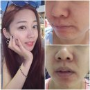궁중비책^^ 마이퓨어 수딩마스크&amp;마이퓨어치약♡