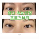 천곡중학교 | 월계동속눈썹 포르스뷰티 첨단속눈썹 월계동네일 같이하는 토탈샵