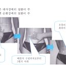 <스파이럴> 수독, 어혈의 판정법 이미지