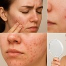 비오메디칼 이미지