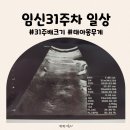 멕플러스 | 임신31주 배크기 태아몸무게 임산부일상기록
