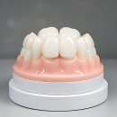 웰빙치과의원 | 이빨이 시릴 땐 묻따말 나의 구세주 치과 찾기