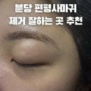 분당서현역 한의원 편평사마귀 성지 제거 잘하는곳 가성비 추천 비용 후기