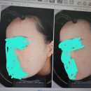 리쥬앤힐의원 네이버블로그