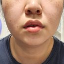 닥터오아시스랩 스피큘앰플 로 집에서 하는 찐 홈케어 피부관리 후기