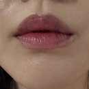 노원하나약국 | 노원 피부과 입술 점 제거 3달 경과 후기, 가격, 점빼기 통증