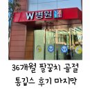 세븐일레븐 대구W병원점 | 36개월 팔꿈치 골절 통깁스 후기 마지막 (대구 W병원)