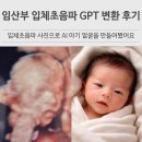 프롬프트 | 입체초음파 사진 AI 변환 gpt 제미나이 프롬프트 임산부 후기